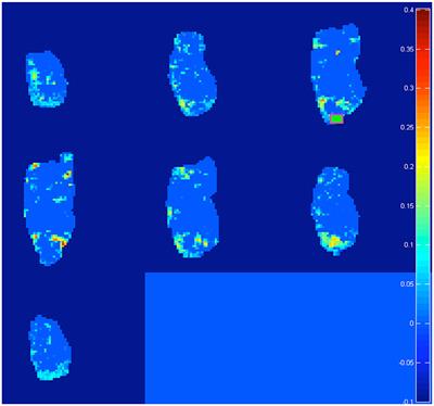 Inside the Developing Brain to Understand Teen Behavior From Rat Models: Metabolic, Structural, and Functional-Connectivity Alterations Among Limbic Structures Across Three Pre-adolescent Stages